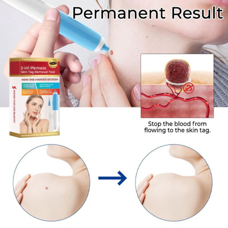 GlowEssence™ — Painlessly Banish Skin Tags in Just Days