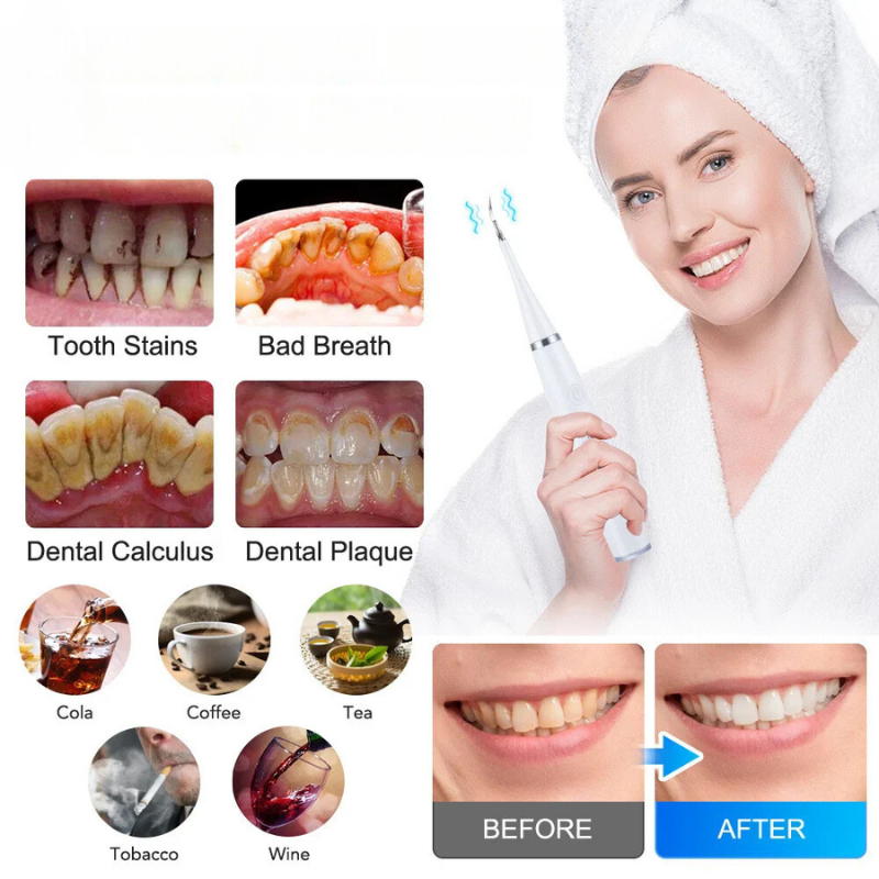 BrightSmile™ — Achieve a Dazzling Smile in One Simple Step