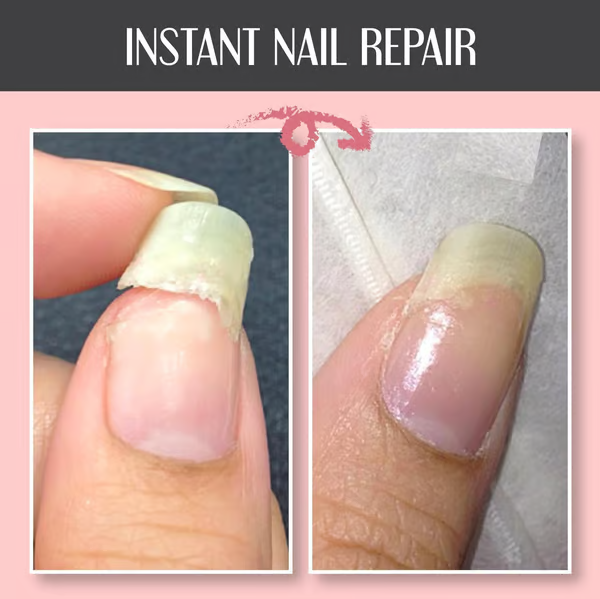 NailGuard™ — Restore Strength and Shine in Just 7 Days
