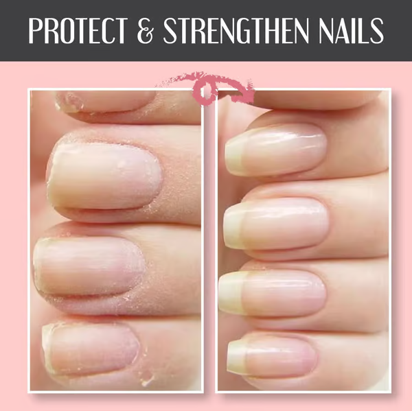 NailGuard™ — Restore Strength and Shine in Just 7 Days