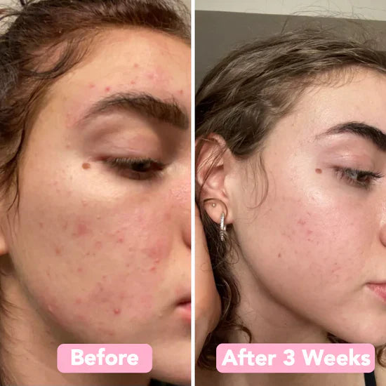 Velleara™ - Brighten Your Skin in Just Weeks!