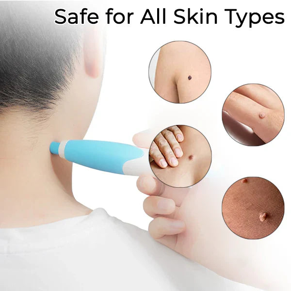 GlowEssence™ — Painlessly Banish Skin Tags in Just Days