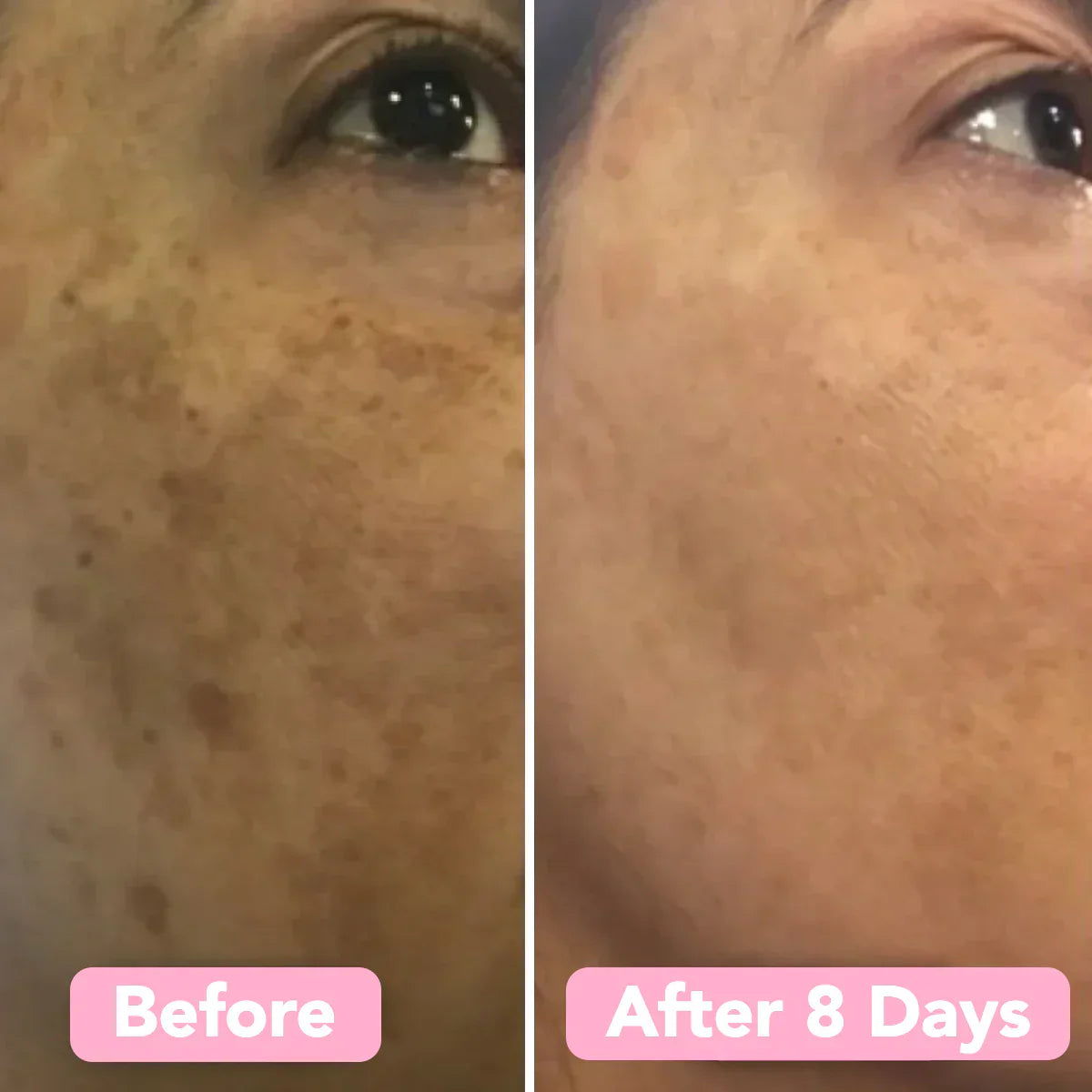 Velleara™ - Brighten Your Skin in Just Weeks!