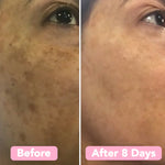 Velleara™ - Brighten Your Skin in Just Weeks!