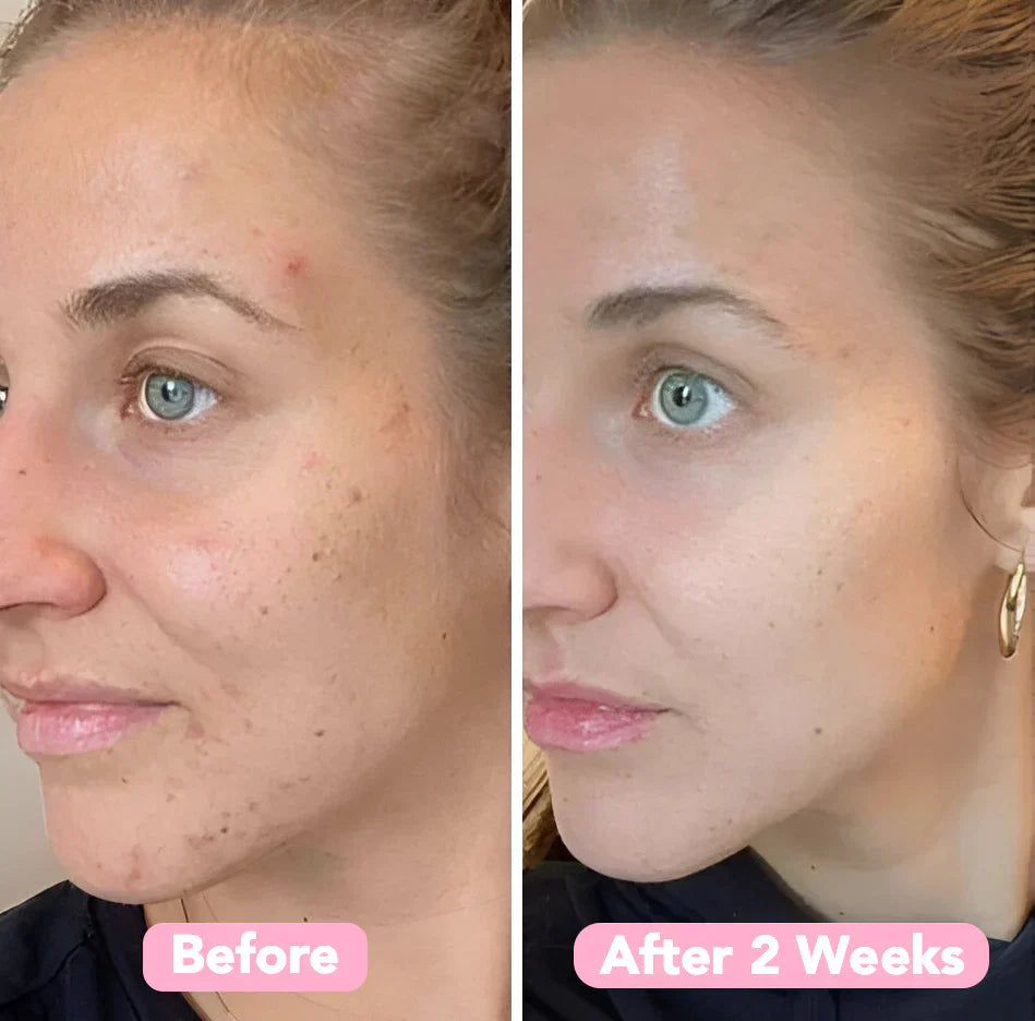 Velleara™ - Brighten Your Skin in Just Weeks!