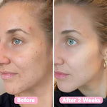 Velleara™ - Brighten Your Skin in Just Weeks!