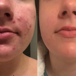 DermCare™ - Achieve Flawlessly Smooth Skin in Just 2 Weeks!