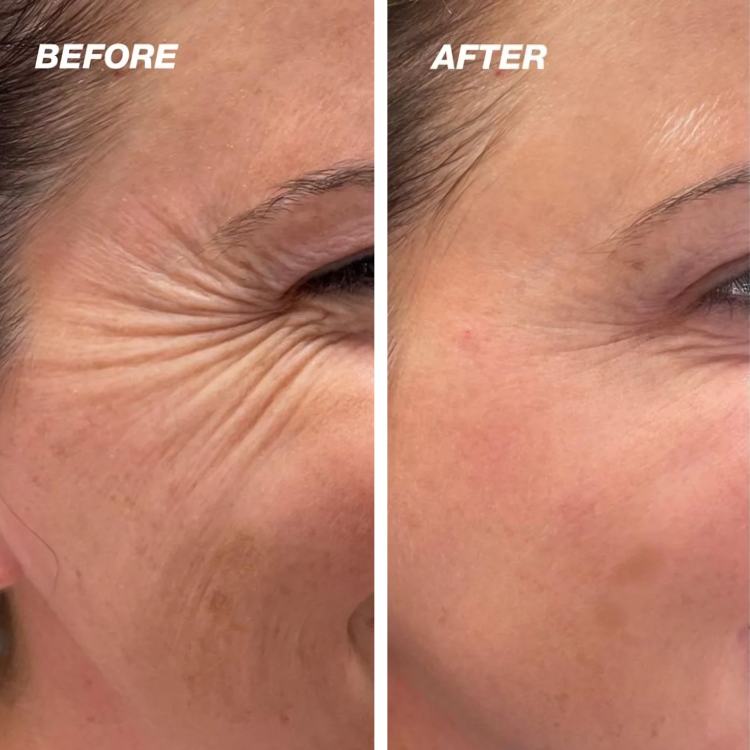 DermCare™ - Reveal Flawless Skin in Just Weeks!