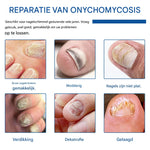 MycoStop™ - Restore Healthy Nails in Just Weeks!