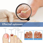 MycoStop™ - Regain Healthy Nails & Confidence in Weeks!