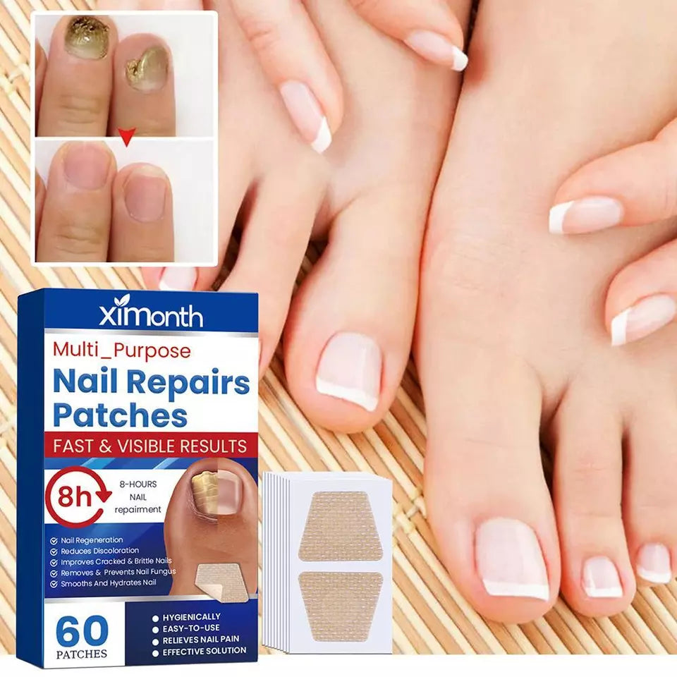 MycoStop™ - Restore Healthy Nails in Just Weeks!