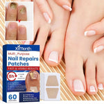 MycoStop™ - Restore Healthy Nails in Just Weeks!